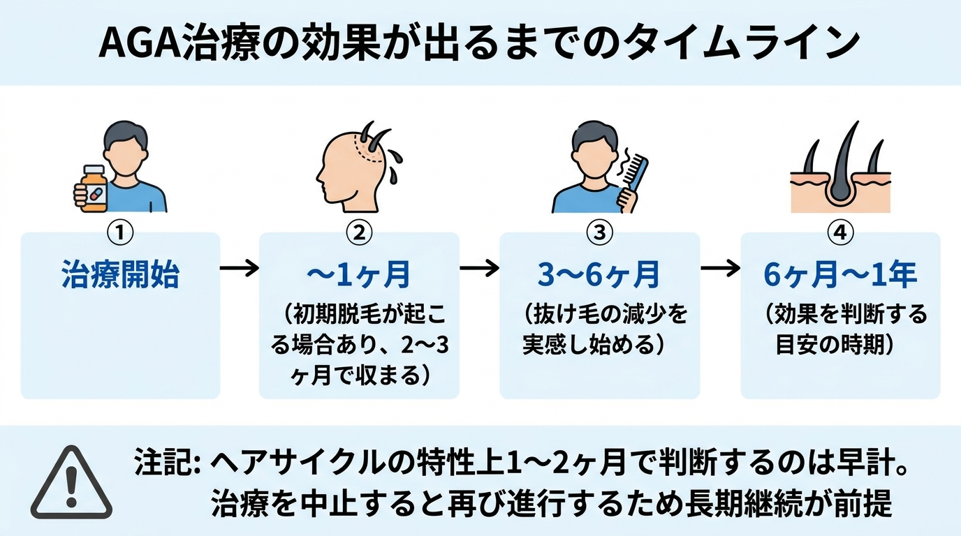 タイトル: AGA治療の効果が出るまでのタイムライン。横軸に時間を取ったフロー図: 治療開始〜1ヶ月(初期脱毛が起こる場合あり、2〜3ヶ月で収まる)→ 3〜6ヶ月(抜け毛の減少を実感し始める)→ 6ヶ月〜1年(効果を判断する目安の時期)。下部に注記: ヘアサイクルの特性上1〜2ヶ月で判断するのは早計。治療を中止すると再び進行するため長期継続が前提