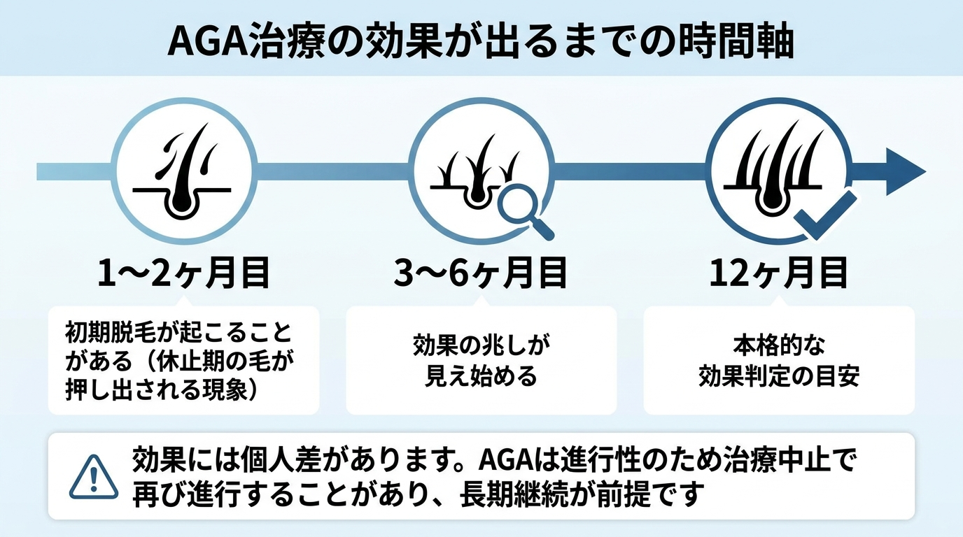 タイトル: AGA治療の効果が出るまでの時間軸。横並びタイムライン: 1〜2ヶ月目: 初期脱毛が起こることがある(休止期の毛が押し出される現象)。3〜6ヶ月目: 効果の兆しが見え始める。12ヶ月目: 本格的な効果判定の目安。下部に注記『効果には個人差があります。AGAは進行性のため治療中止で再び進行することがあり、長期継続が前提です』