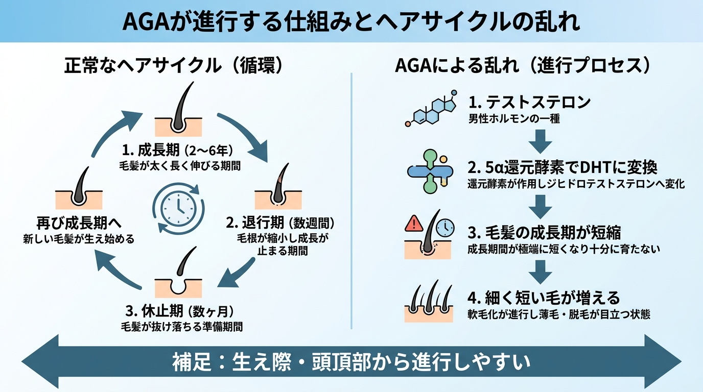 タイトル: AGAが進行する仕組みとヘアサイクルの乱れ。左右2パートのイラスト図。左: 正常なヘアサイクル(成長期2〜6年→退行期→休止期→再び成長期の円環図)。右: AGAによる乱れ(テストステロン→5α還元酵素でDHTに変換→毛髪の成長期が短縮→細く短い毛が増える の縦フロー)。下部に矢印で「生え際・頭頂部から進行しやすい」と補足