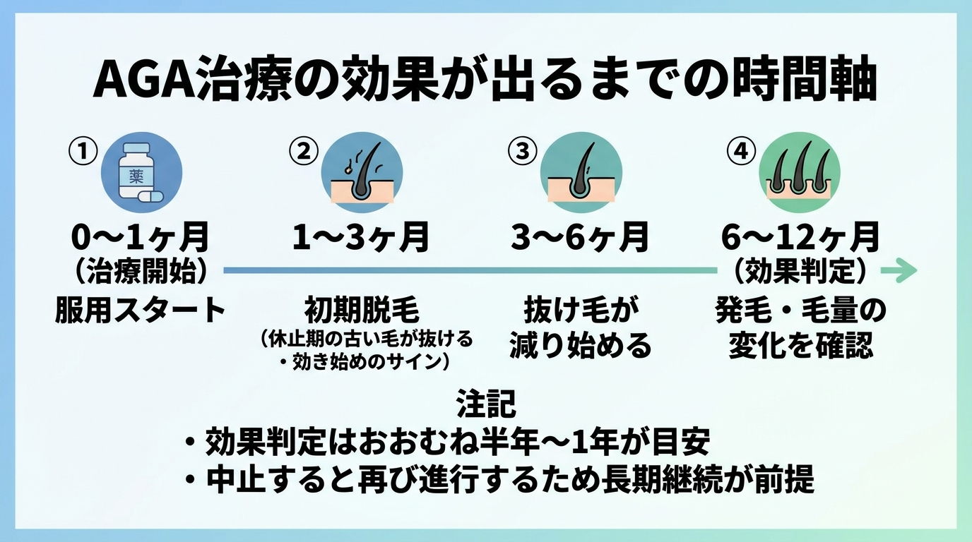 タイトル: AGA治療の効果が出るまでの時間軸。横向きのタイムライン図で: 0〜1ヶ月（治療開始）: 服用スタート。1〜3ヶ月: 初期脱毛（休止期の古い毛が抜ける・効き始めのサイン）。3〜6ヶ月: 抜け毛が減り始める。6〜12ヶ月（効果判定）: 発毛・毛量の変化を確認。下部に注記: 効果判定はおおむね半年〜1年が目安。中止すると再び進行するため長期継続が前提