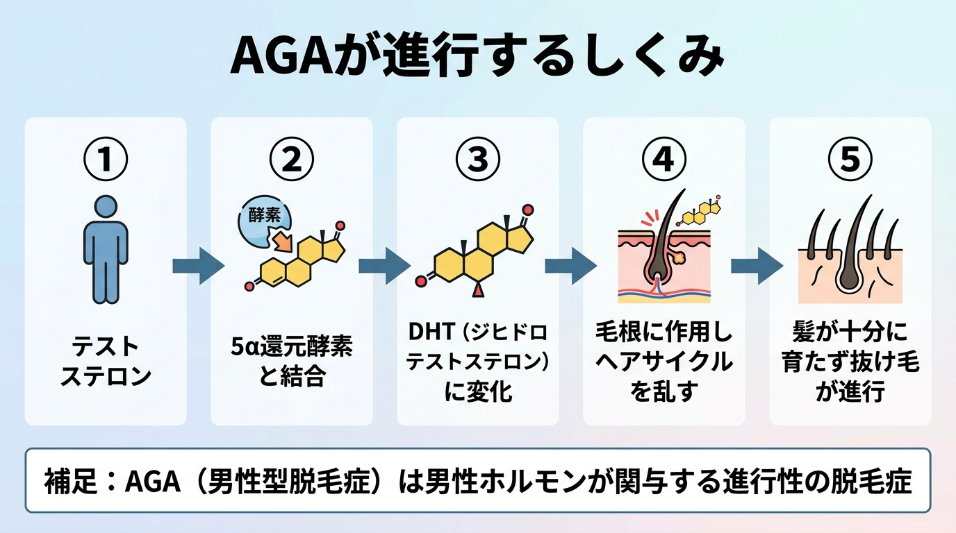 タイトル: AGAが進行するしくみ。フロー図(左から右へ矢印でつなぐ): ①テストステロン → ②5α還元酵素と結合 → ③DHT(ジヒドロテストステロン)に変化 → ④毛根に作用しヘアサイクルを乱す → ⑤髪が十分に育たず抜け毛が進行。補足: AGA(男性型脱毛症)は男性ホルモンが関与する進行性の脱毛症。
