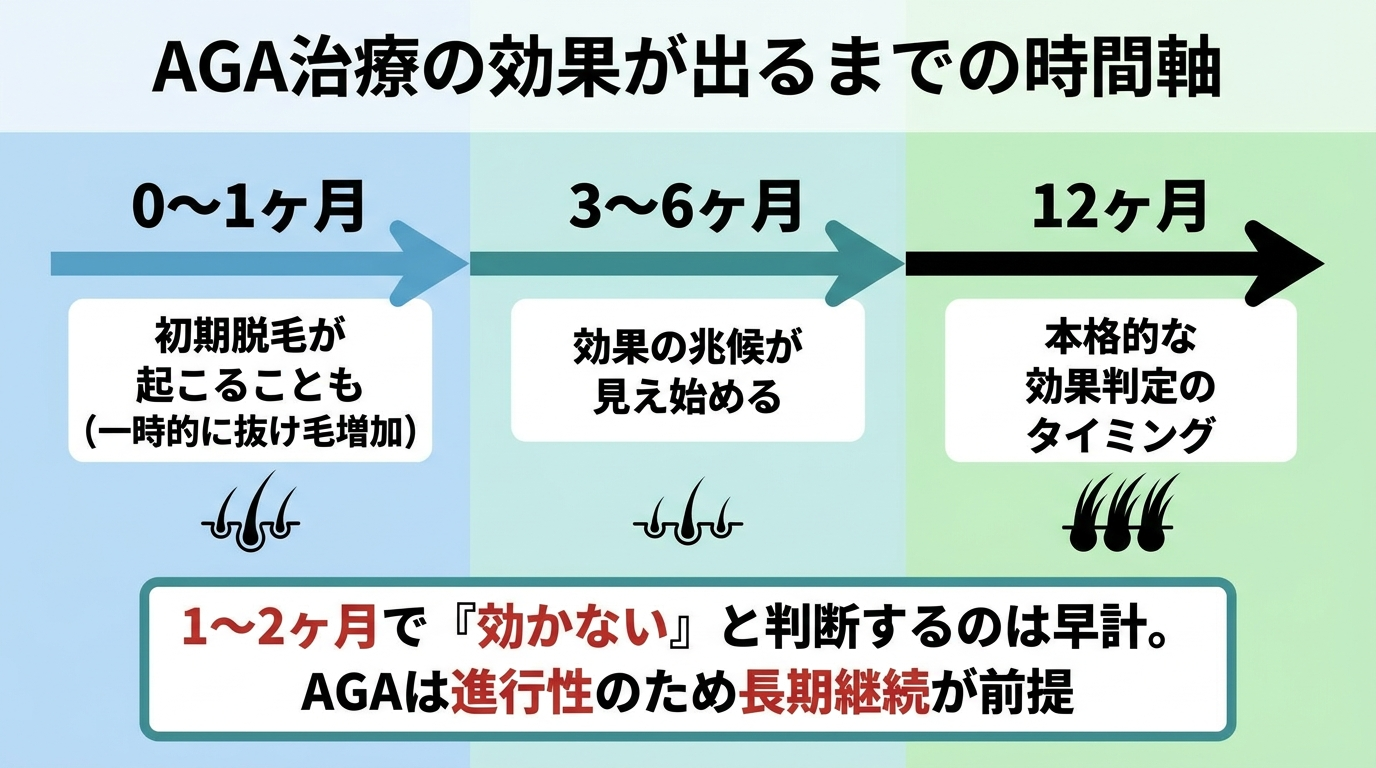 タイトル: AGA治療の効果が出るまでの時間軸。左から右への横棒タイムライン図: 0〜1ヶ月: 初期脱毛が起こることも(一時的に抜け毛増加)。3〜6ヶ月: 効果の兆候が見え始める。12ヶ月: 本格的な効果判定のタイミング。下部注記: 1〜2ヶ月で『効かない』と判断するのは早計。AGAは進行性のため長期継続が前提