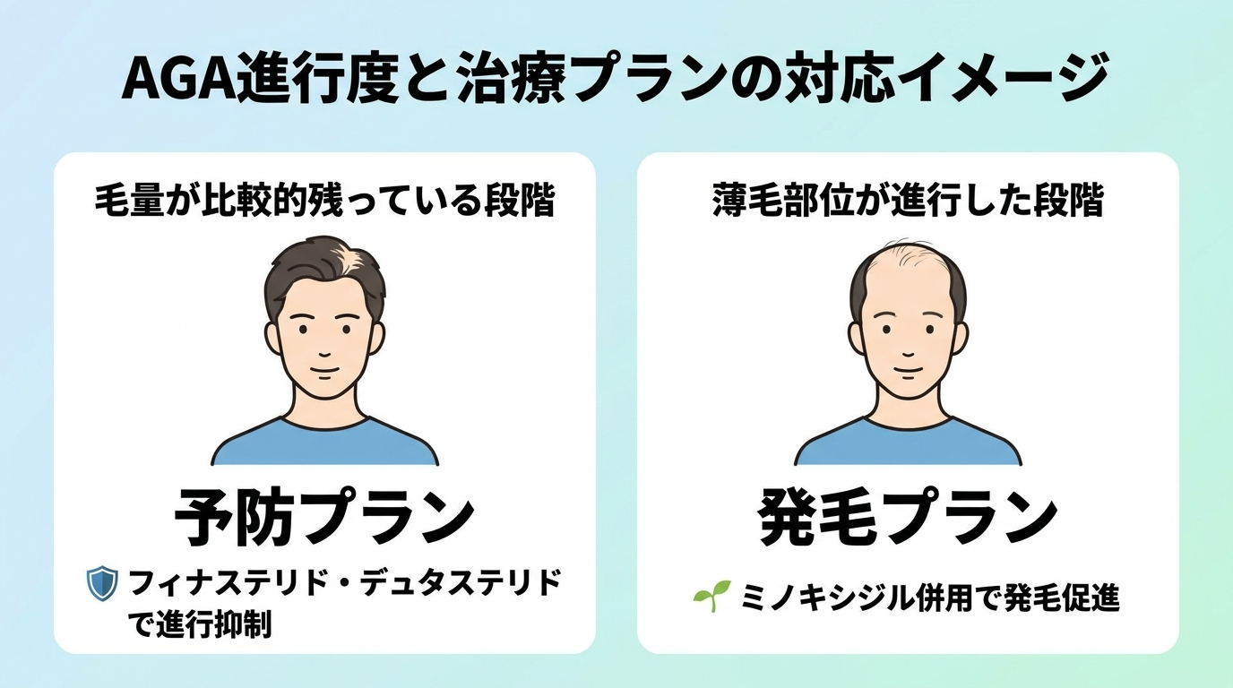 タイトル: AGA進行度と治療プランの対応イメージ。イラスト2カード横並び: カード1(毛量が比較的残っている段階)予防プラン=フィナステリド・デュタステリドで進行抑制。カード2(薄毛部位が進行した段階)発毛プラン=ミノキシジル併用で発毛促進