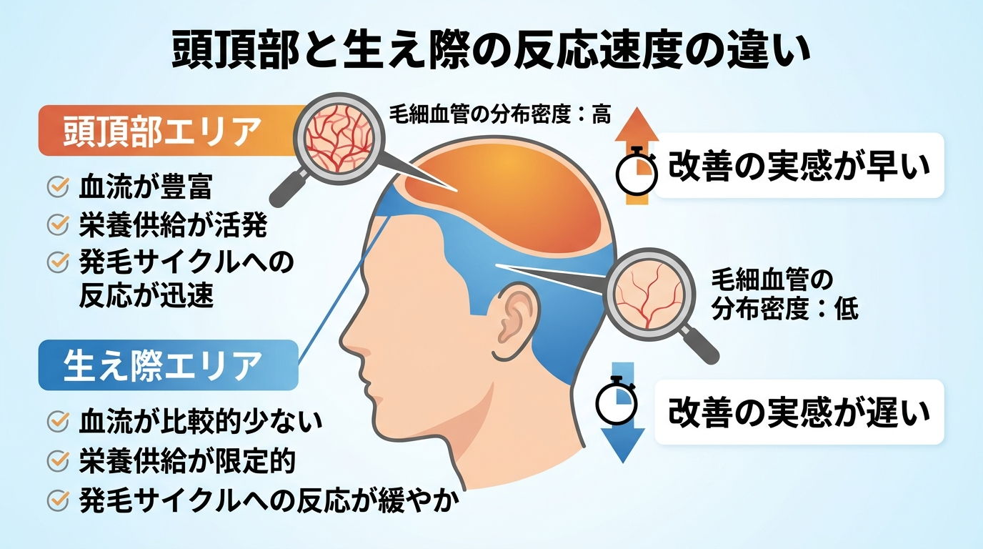 タイトル: 頭頂部と生え際の反応速度の違い。イラスト: 頭部を横から見た図で、頭頂部エリアと生え際エリアを色分けし、それぞれに毛細血管の分布密度と矢印で「改善の実感が早い」「改善の実感が遅い」と対比表示
