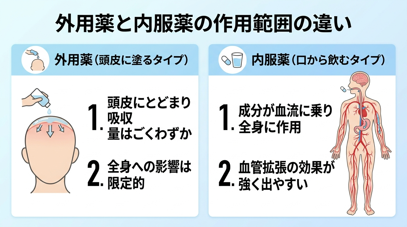 タイトル: 外用薬と内服薬の作用範囲の違い。横並び2パネル。パネル1見出し: 外用薬(頭皮に塗るタイプ)、内容: 頭皮にとどまり吸収量はごくわずか、全身への影響は限定的。パネル2見出し: 内服薬(口から飲むタイプ)、内容: 成分が血流に乗り全身に作用、血管拡張の効果が強く出やすい