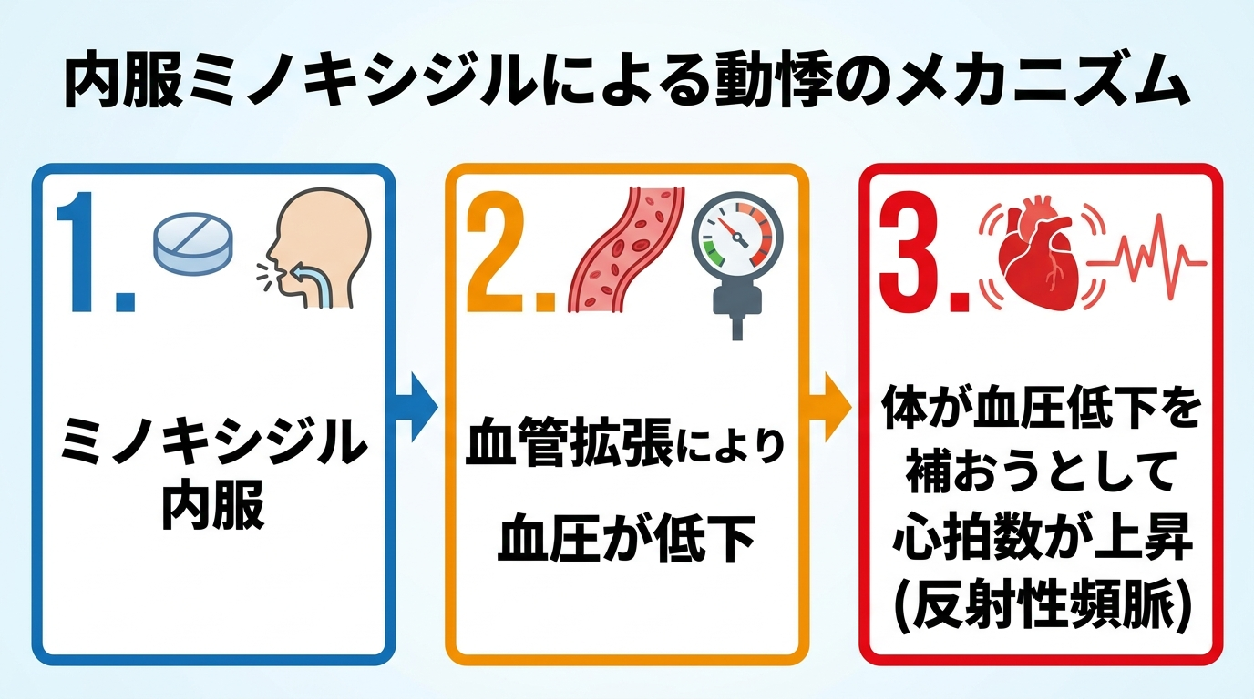 タイトル: 内服ミノキシジルによる動悸のメカニズム。フロー図3ステップ: ステップ1「ミノキシジル内服」→ステップ2「血管拡張により血圧が低下」→ステップ3「体が血圧低下を補おうとして心拍数が上昇(反射性頻脈)」。