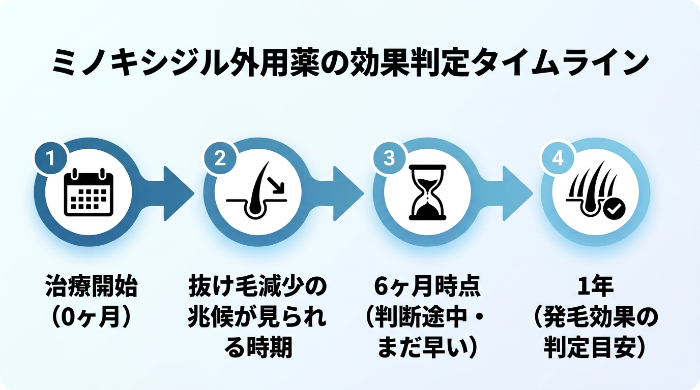 タイトル: ミノキシジル外用薬の効果判定タイムライン。横並びの4ステップタイムライン図。ステップ1: 治療開始(0ヶ月)。ステップ2: 抜け毛減少の兆候が見られる時期。ステップ3: 6ヶ月時点(判断途中・まだ早い)。ステップ4: 1年(発毛効果の判定目安)。各ステップを矢印でつなぐ。