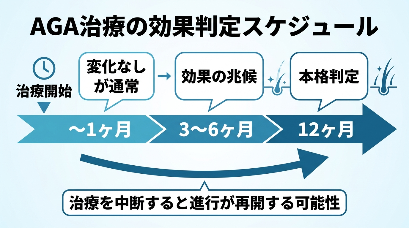 タイトル: AGA治療の効果判定スケジュール。横軸タイムライン: 治療開始〜1ヶ月(変化なしが通常)、3〜6ヶ月(効果の兆候)、12ヶ月(本格判定)。矢印下に注記『治療を中断すると進行が再開する可能性』。