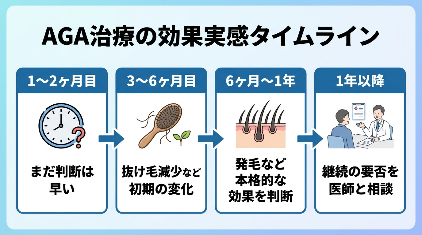 タイトル: AGA治療の効果実感タイムライン。横軸に時系列で4段階: 1〜2ヶ月目 | まだ判断は早い。3〜6ヶ月目 | 抜け毛減少など初期の変化。6ヶ月〜1年 | 発毛など本格的な効果を判断。1年以降 | 継続の要否を医師と相談