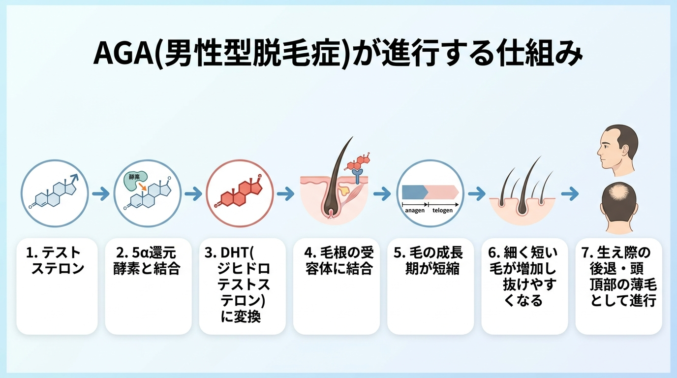 タイトル: AGA(男性型脱毛症)が進行する仕組み。フロー図: テストステロン→5α還元酵素と結合→DHT(ジヒドロテストステロン)に変換→毛根の受容体に結合→毛の成長期が短縮→細く短い毛が増加し抜けやすくなる→生え際の後退・頭頂部の薄毛として進行。
