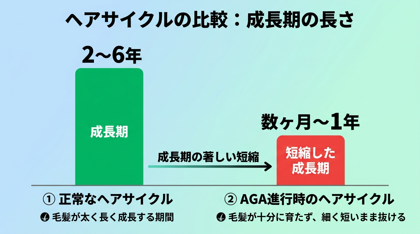 ヘアサイクル比較の棒グラフ。左のバー: 正常な成長期(2〜6年)。右のバー: AGA進行時に短縮した成長期(数ヶ月〜1年)。バーの長さの違いで成長期短縮を視覚化