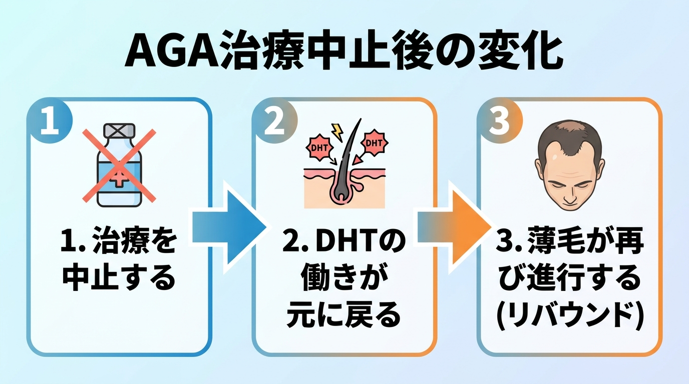 タイトル: AGA治療中止後の変化。3ステップの矢印図: ステップ1「治療を中止する」→ステップ2「DHTの働きが元に戻る」→ステップ3「薄毛が再び進行する(リバウンド)」