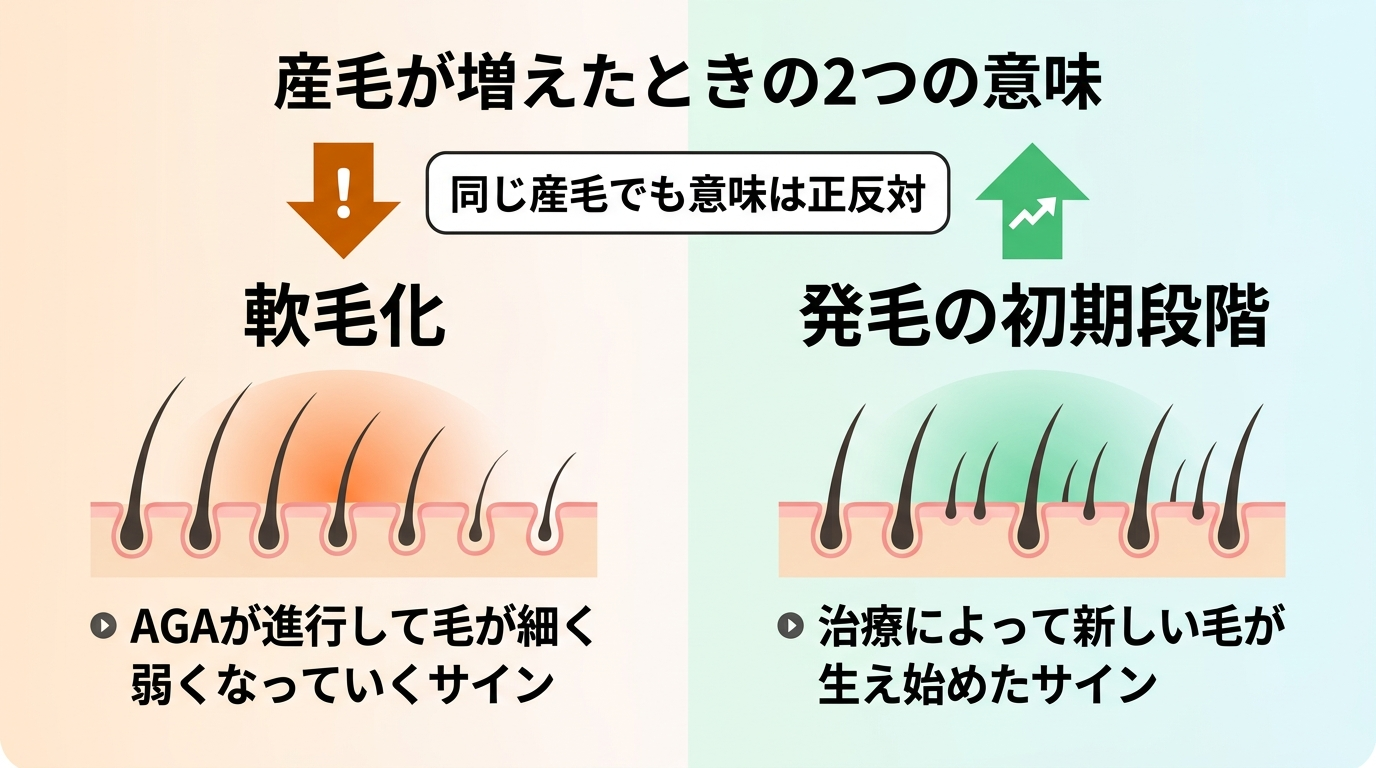 タイトル: 産毛が増えたときの2つの意味。左右対比イラスト2枚。左側(下向き矢印・警告色): 見出し「軟毛化」、説明: AGAが進行して毛が細く弱くなっていくサイン。右側(上向き矢印・ポジティブ色): 見出し「発毛の初期段階」、説明: 治療によって新しい毛が生え始めたサイン。中央に「同じ産毛でも意味は正反対」の注記。