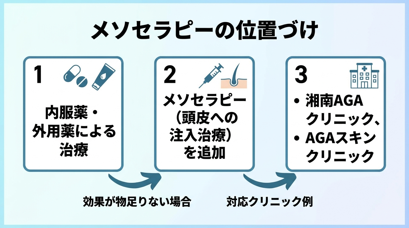 タイトル: メソセラピーの位置づけ。フロー図: 内服薬・外用薬による治療 → 効果が物足りない場合 → メソセラピー(頭皮への注入治療)を追加 → 対応クリニック例: 湘南AGAクリニック、AGAスキンクリニック