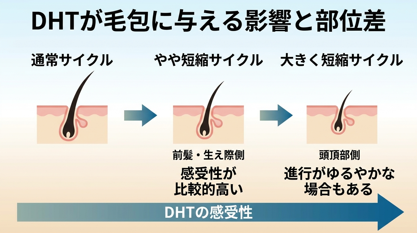 タイトル: DHTが毛包に与える影響と部位差。イラスト: 毛包の成長期が通常サイクルから短縮されていく様子を3段階の毛包図(通常→やや短縮→大きく短縮)で表現。矢印で「DHTの感受性」が部位により異なることを示し、前髪・生え際側に「感受性が比較的高い」というラベル、頭頂部側に「進行がゆるやかな場合もある」というラベルを添える。