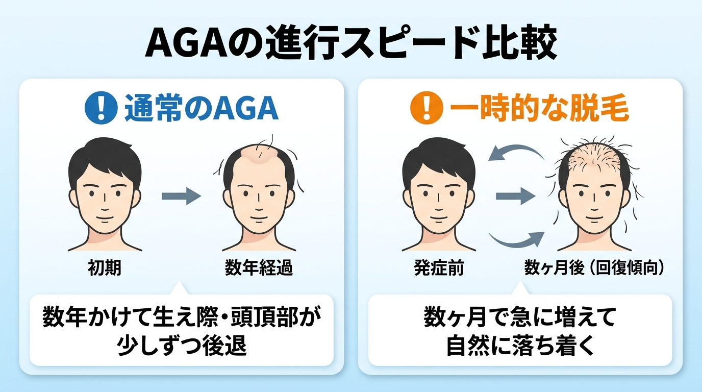 タイトル: AGAの進行スピード比較。イラスト2枚を並べたビフォーアフター図。イラスト1見出し「通常のAGA」説明「数年かけて生え際・頭頂部が少しずつ後退」。イラスト2見出し「一時的な脱毛」説明「数ヶ月で急に増えて自然に落ち着く」。