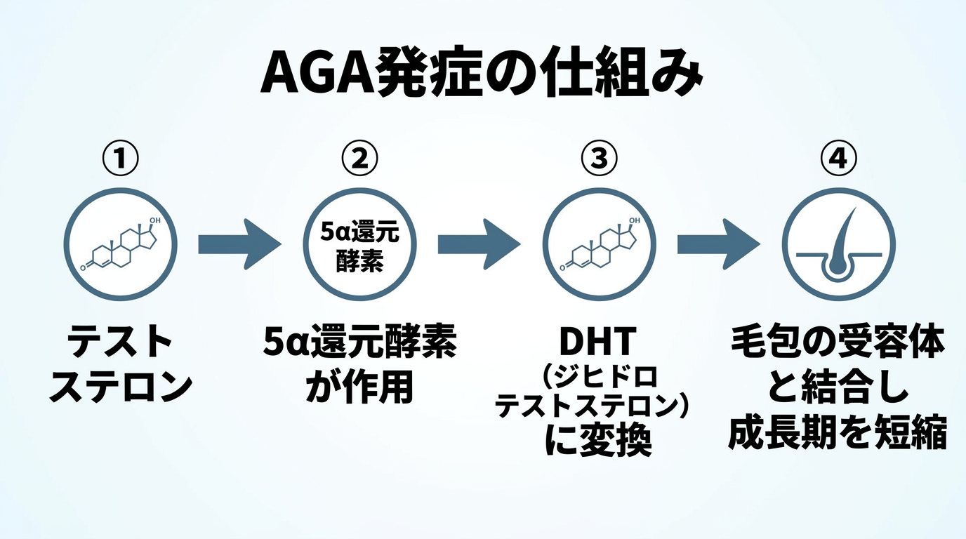 タイトル: AGA発症の仕組み。ステップ1:テストステロン。ステップ2:5α還元酵素が作用。ステップ3:DHT(ジヒドロテストステロン)に変換。ステップ4:毛包の受容体と結合し成長期を短縮。矢印で4ステップを順に接続した図。