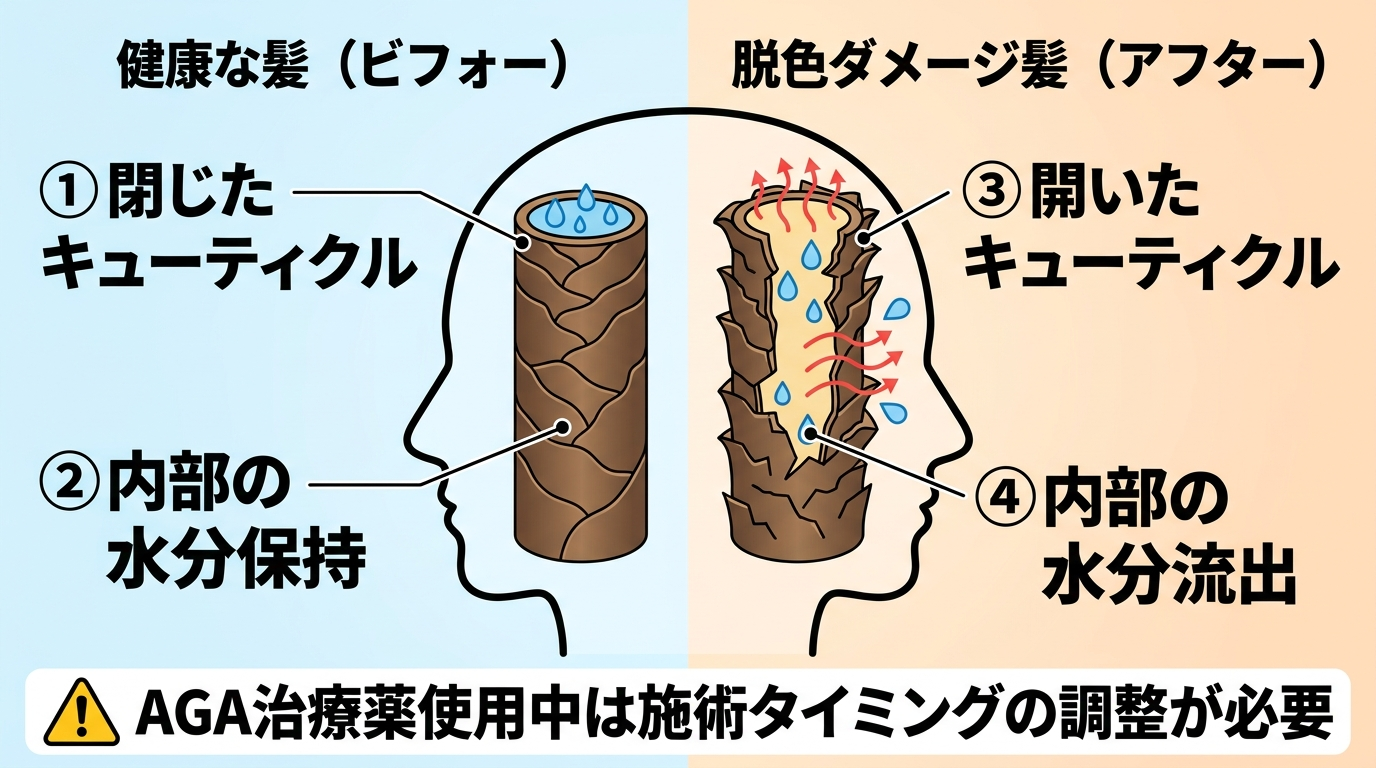 タイトル: 薄毛と脱色の関係を示すビフォーアフター断面イラスト。頭部シルエットを左右2分割し、左側は健康な髪(キューティクルが閉じた状態)、右側は脱色でダメージを受けた髪(キューティクルが開き内部の水分が流出する様子)を対比表示。下部にテキストラベル「AGA治療薬使用中は施術タイミングの調整が必要」