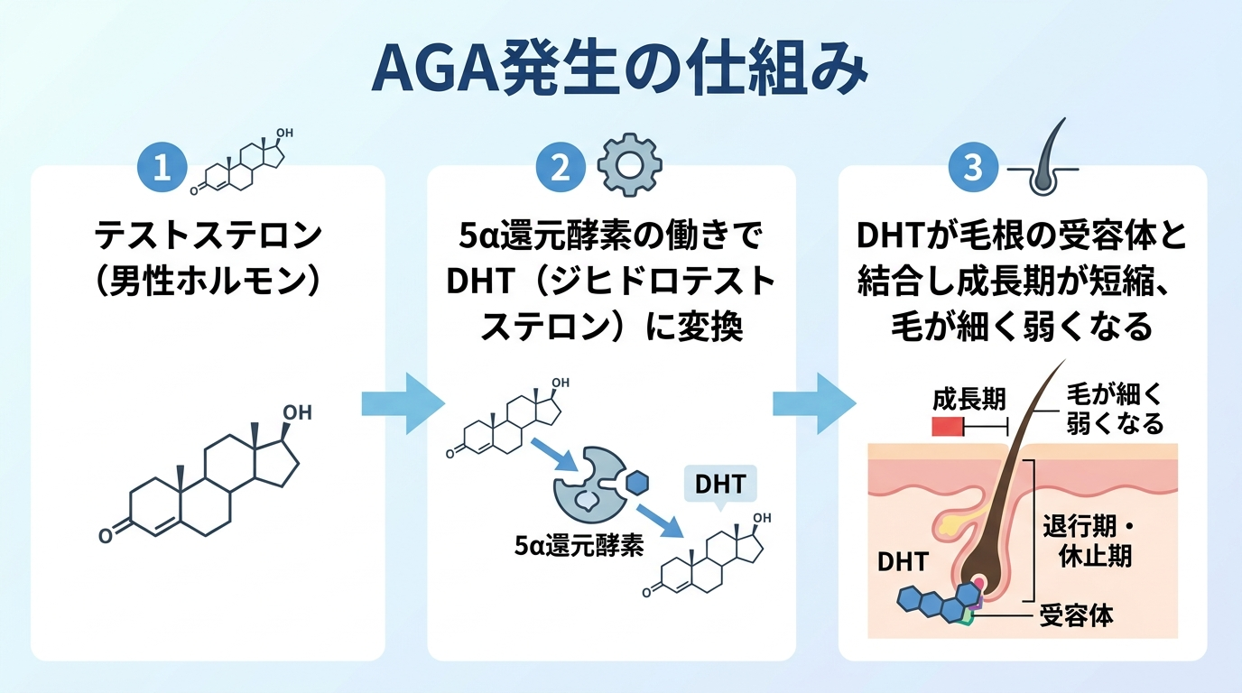 タイトル: AGA発生の仕組み。フロー図3ステップ: ステップ1 テストステロン(男性ホルモン)、ステップ2 5α還元酵素の働きでDHT(ジヒドロテストステロン)に変換、ステップ3 DHTが毛根の受容体と結合し成長期が短縮、毛が細く弱くなる。