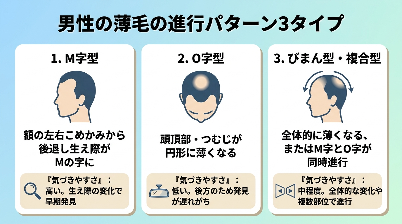 タイトル: 男性の薄毛の進行パターン3タイプ。横並び3カードで頭部イラスト付き。カード1: M字型 — 額の左右こめかみから後退し生え際がMの字に。カード2: O字型 — 頭頂部・つむじが円形に薄くなる。カード3: びまん型・複合型 — 全体的に薄くなる、またはM字とO字が同時進行。各カードに『気づきやすさ』の注記を添える