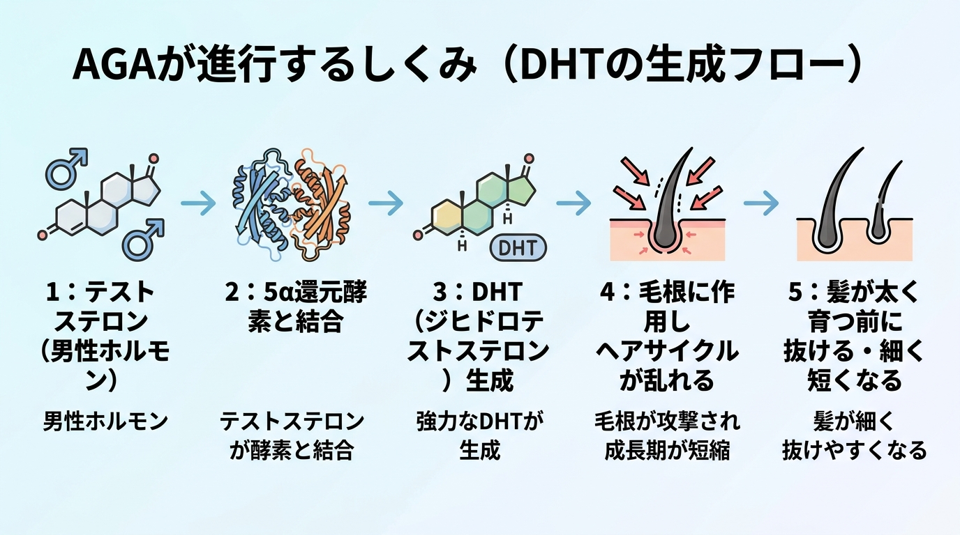 タイトル: AGAが進行するしくみ(DHTの生成フロー)。左から右への横フロー図: ステップ1: テストステロン(男性ホルモン)→ ステップ2: 5α還元酵素と結合 → ステップ3: DHT(ジヒドロテストステロン)生成 → ステップ4: 毛根に作用しヘアサイクルが乱れる → ステップ5: 髪が太く育つ前に抜ける・細く短くなる。各ステップをアイコン付きで表示