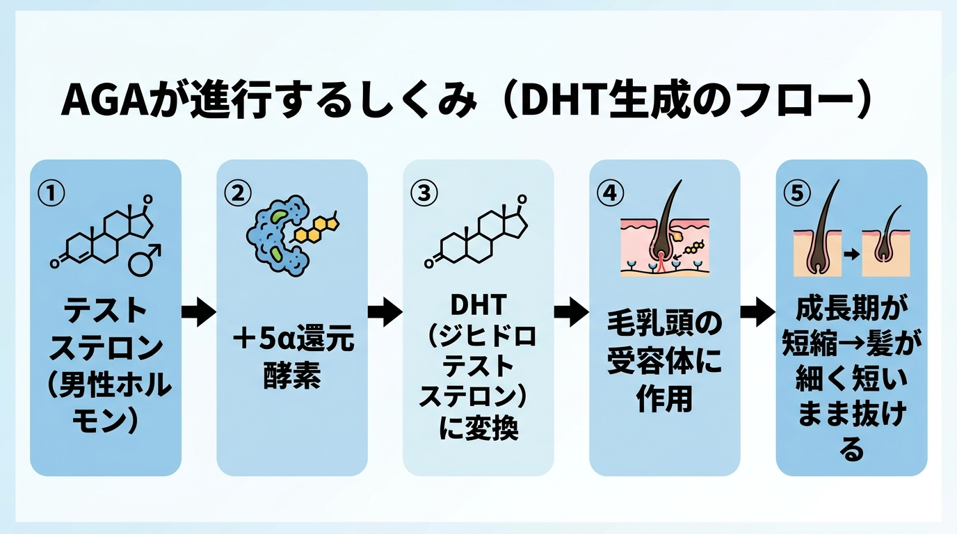タイトル: AGAが進行するしくみ(DHT生成のフロー)。フロー図で左から右へ。ステップ1: テストステロン(男性ホルモン)。ステップ2: +5α還元酵素。ステップ3: DHT(ジヒドロテストステロン)に変換。ステップ4: 毛乳頭の受容体に作用。ステップ5: 成長期が短縮→髪が細く短いまま抜ける