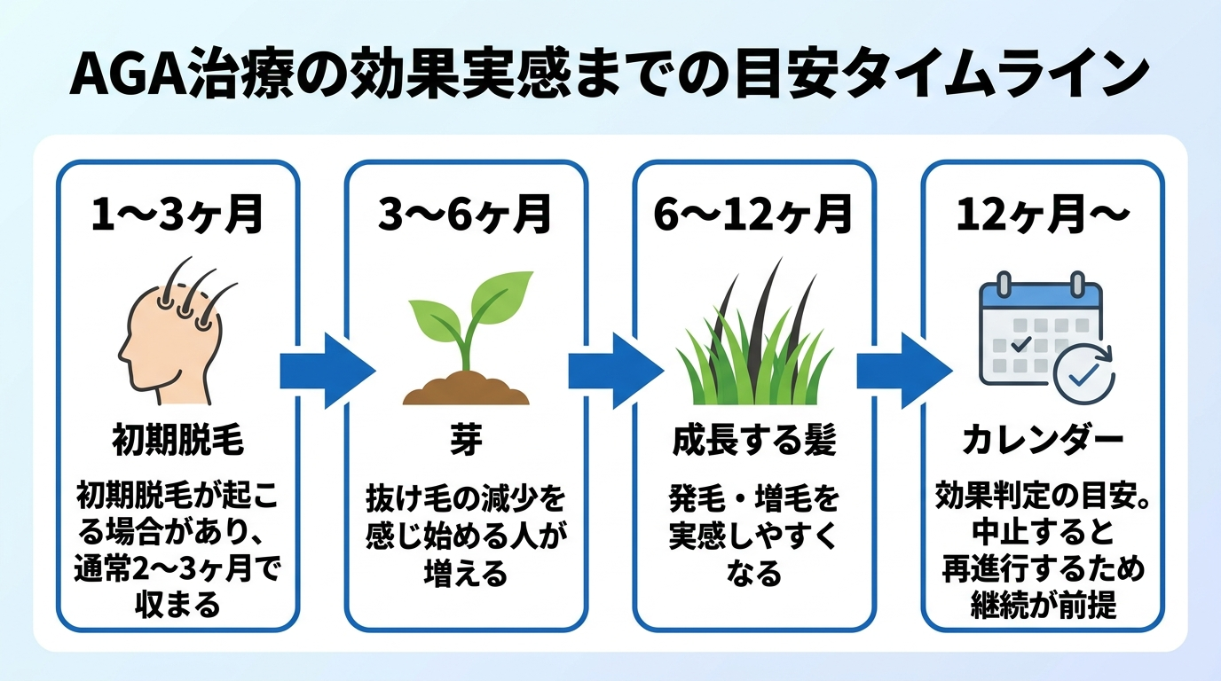 タイトル: AGA治療の効果実感までの目安タイムライン。横並び4段階のフロー図で: 1〜3ヶ月(初期脱毛のアイコン)初期脱毛が起こる場合があり、通常2〜3ヶ月で収まる。3〜6ヶ月(芽のアイコン)抜け毛の減少を感じ始める人が増える。6〜12ヶ月(成長する髪のアイコン)発毛・増毛を実感しやすくなる。12ヶ月〜(カレンダーのアイコン)効果判定の目安。中止すると再進行するため継続が前提