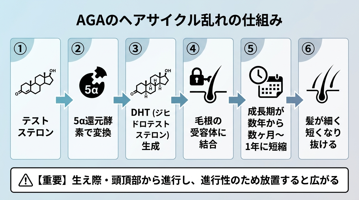タイトル: AGAのヘアサイクル乱れの仕組み。フロー図: ①テストステロン → ②5α還元酵素で変換 → ③DHT（ジヒドロテストステロン）生成 → ④毛根の受容体に結合 → ⑤成長期が数年から数ヶ月〜1年に短縮 → ⑥髪が細く短くなり抜ける。生え際・頭頂部から進行し、進行性のため放置すると広がる。