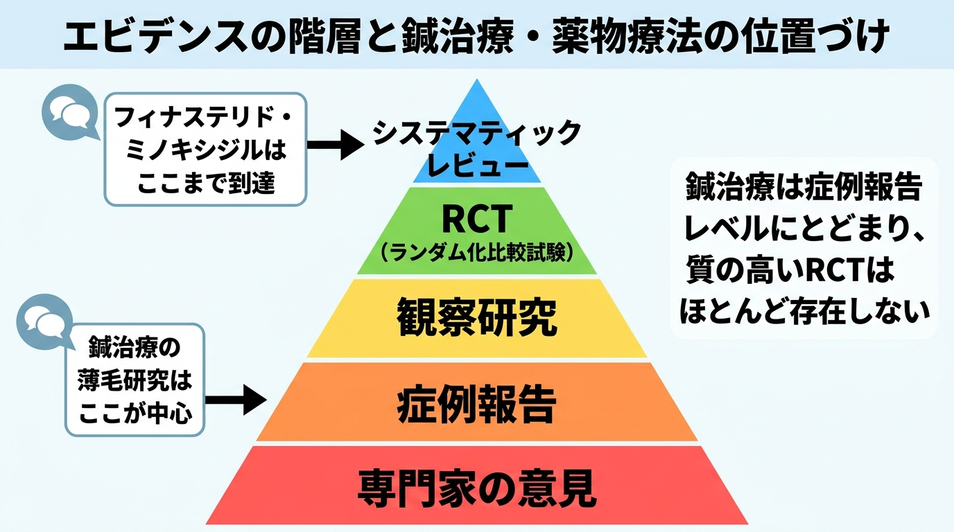 タイトル: エビデンスの階層と鍼治療・薬物療法の位置づけ。ピラミッド図の下から上へ: 最下層=専門家の意見、下層=症例報告（鍼治療の薄毛研究はここが中心）、中層=観察研究、上層=RCT（ランダム化比較試験）、最上層=システマティックレビュー（フィナステリド・ミノキシジルはここまで到達）。補足テキスト: 鍼治療は症例報告レベルにとどまり、質の高いRCTはほとんど存在しない