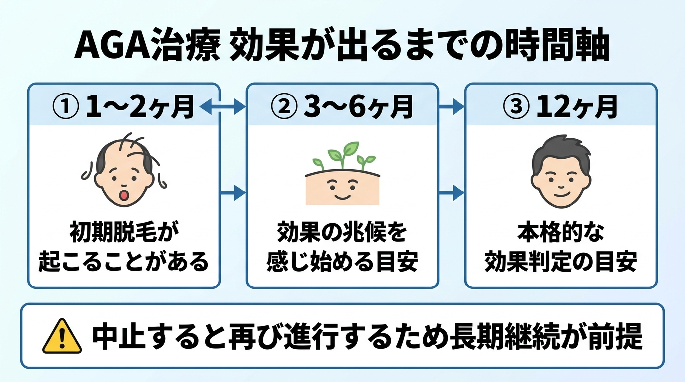 タイトル: AGA治療 効果が出るまでの時間軸。横方向のタイムライン図: 1〜2ヶ月(初期脱毛が起こることがある)→ 3〜6ヶ月(効果の兆候を感じ始める目安)→ 12ヶ月(本格的な効果判定の目安)。下部注釈: 中止すると再び進行するため長期継続が前提