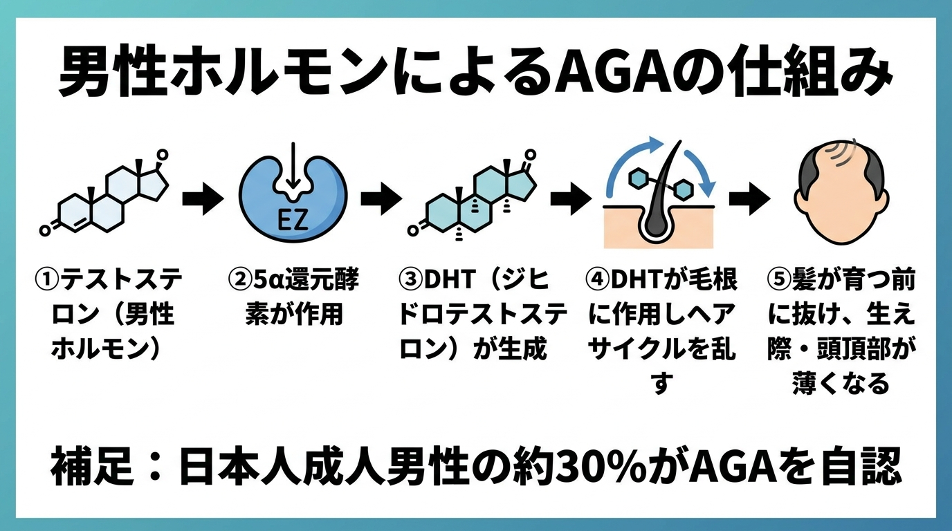 タイトル: 男性ホルモンによるAGAの仕組み。フロー図: ①テストステロン(男性ホルモン)→ ②5α還元酵素が作用 → ③DHT(ジヒドロテストステロン)が生成 → ④DHTが毛根に作用しヘアサイクルを乱す → ⑤髪が育つ前に抜け、生え際・頭頂部が薄くなる。補足: 日本人成人男性の約30%がAGAを自認