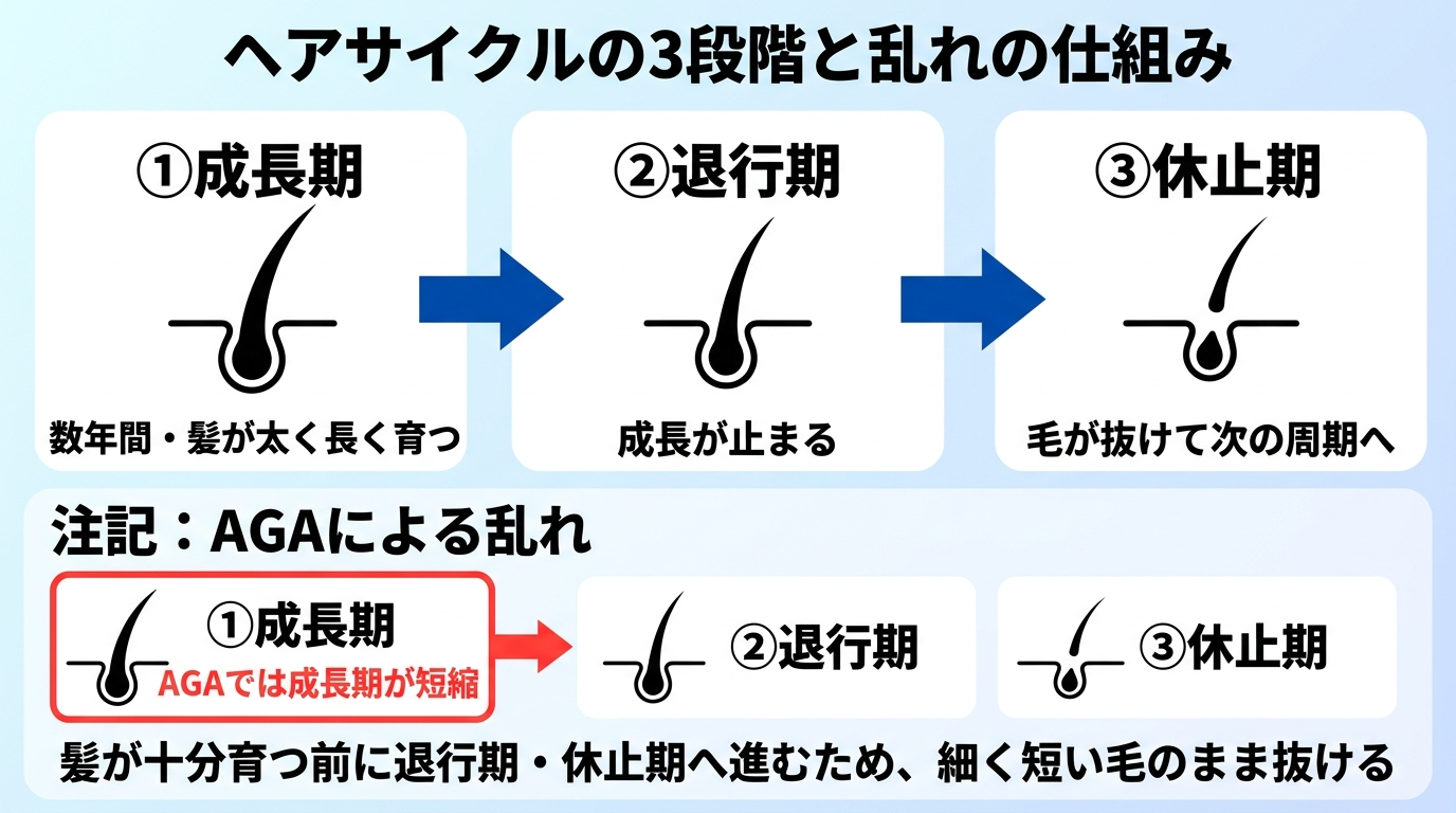 タイトル: ヘアサイクルの3段階と乱れの仕組み。フロー図で3段階を横並び: ①成長期(数年間・髪が太く長く育つ)→ ②退行期(成長が止まる)→ ③休止期(毛が抜けて次の周期へ)。下部に注記: AGAでは成長期が短縮し、髪が十分育つ前に退行期・休止期へ進むため、細く短い毛のまま抜ける