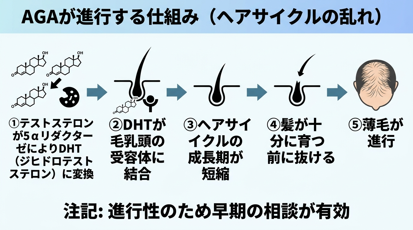 タイトル: AGAが進行する仕組み（ヘアサイクルの乱れ）。左から右への流れ図: ①テストステロンが5αリダクターゼによりDHT（ジヒドロテストステロン）に変換 → ②DHTが毛乳頭の受容体に結合 → ③ヘアサイクルの成長期が短縮 → ④髪が十分に育つ前に抜ける → ⑤薄毛が進行。下部に注記: 進行性のため早期の相談が有効