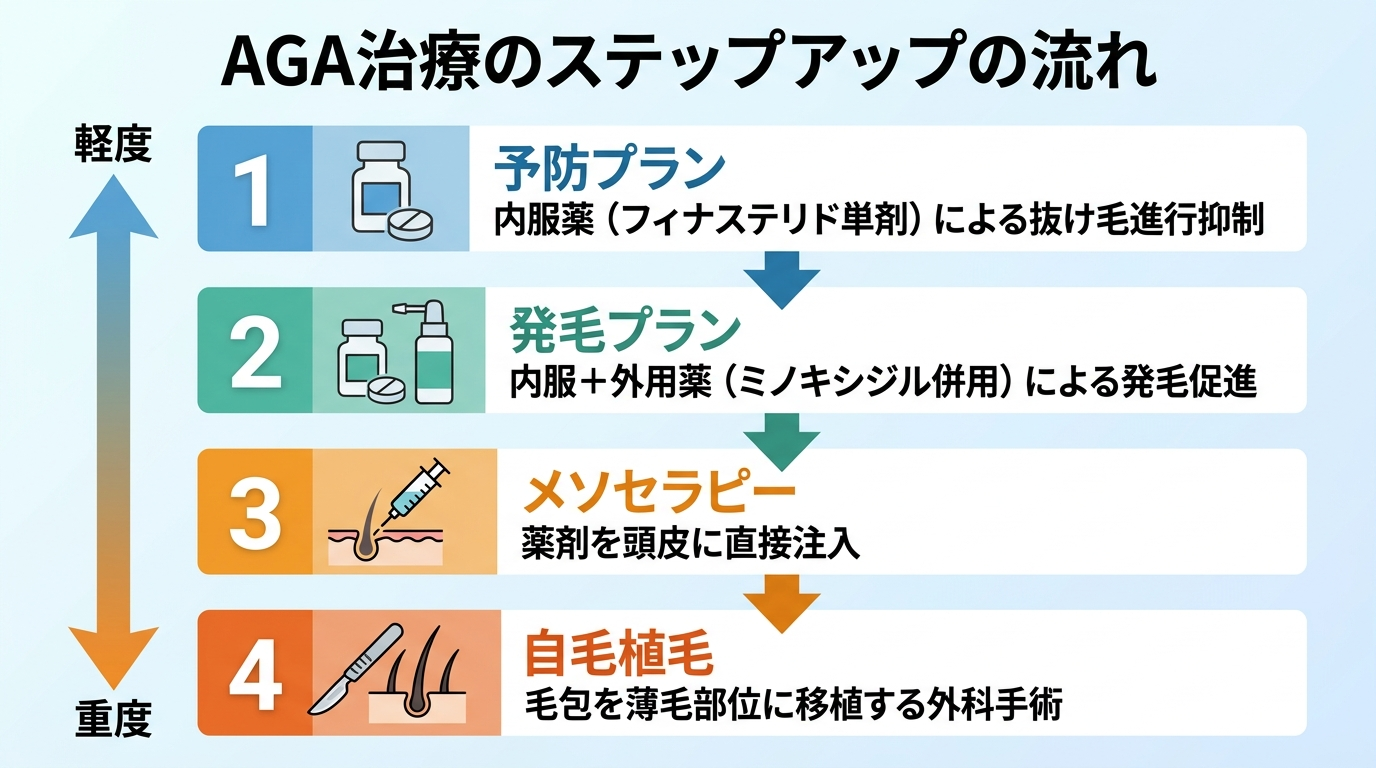 タイトル: AGA治療のステップアップの流れ。縦方向のフロー図。ステップ1(内服薬アイコン)予防プラン: フィナステリド単剤で抜け毛の進行を抑える。ステップ2(内服+外用薬アイコン)発毛プラン: ミノキシジルを併用し発毛を促す。ステップ3(注射器アイコン)メソセラピー: 薬剤を頭皮に直接注入。ステップ4(メスアイコン)自毛植毛: 毛包を薄毛部位に移植する外科手術。矢印で軽度→重度に進むほど選択肢がステップアップすることを示す