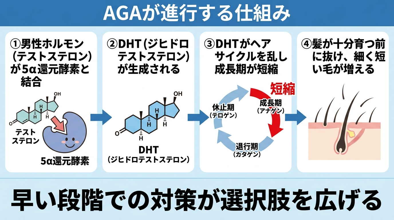 タイトル: AGAが進行する仕組み。左から右へのフロー図: ①男性ホルモン（テストステロン）が5α還元酵素と結合 → ②DHT（ジヒドロテストステロン）が生成される → ③DHTがヘアサイクルを乱し成長期が短縮 → ④髪が十分育つ前に抜け、細く短い毛が増える。下部に説明: 早い段階での対策が選択肢を広げる