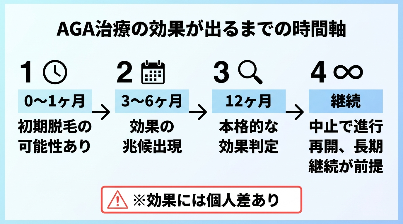 タイトル: AGA治療の効果が出るまでの時間軸。左から右への横向きタイムライン図: 0〜1ヶ月(初期脱毛が起こることがある)→ 3〜6ヶ月(効果の兆候が現れ始める)→ 12ヶ月(本格的な効果判定を行う)→ 継続(中止すると再び進行するため長期継続が前提)。注記: 効果には個人差があります