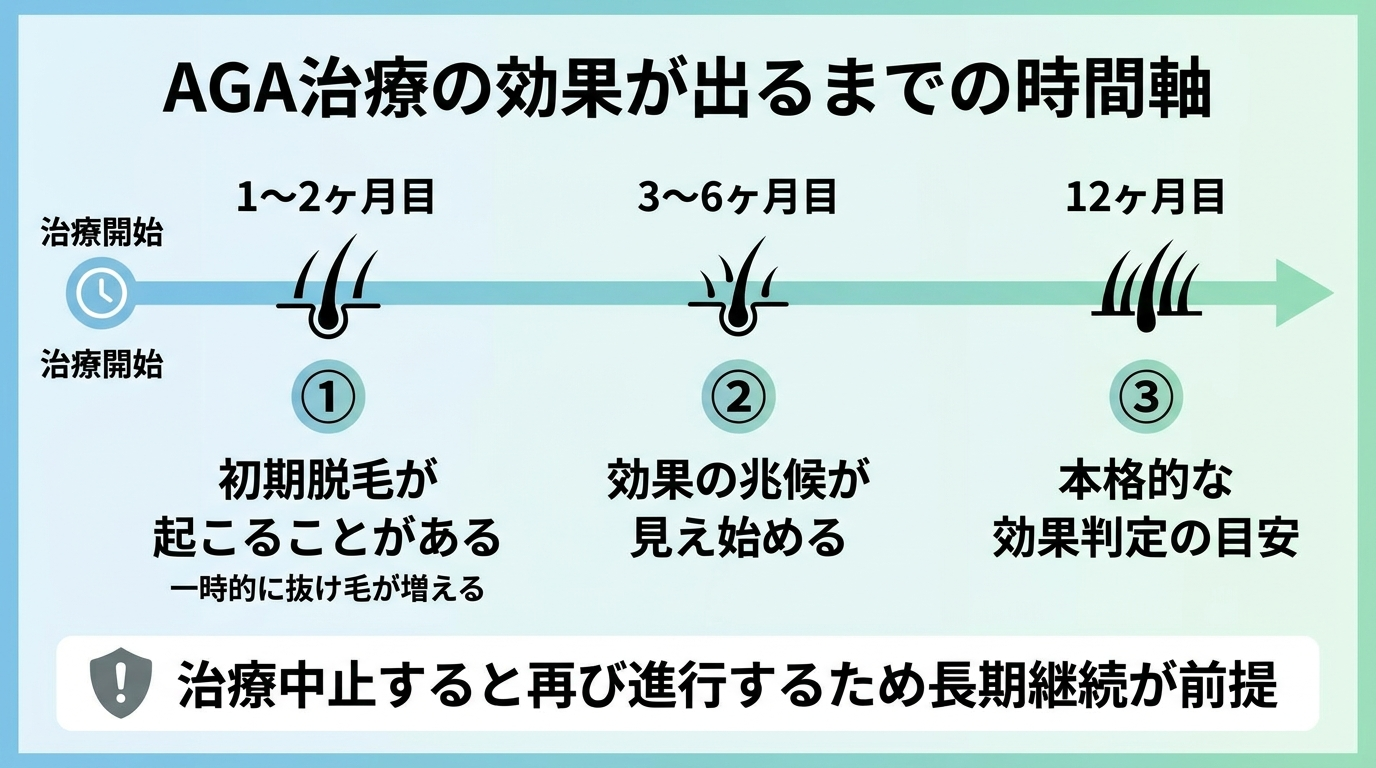 タイトル: AGA治療の効果が出るまでの時間軸。横向きのタイムライン図で: 1〜2ヶ月目:初期脱毛が起こることがある(一時的に抜け毛が増える)。3〜6ヶ月目:効果の兆候が見え始める。12ヶ月目:本格的な効果判定の目安。治療中止すると再び進行するため長期継続が前提、と注記を添える