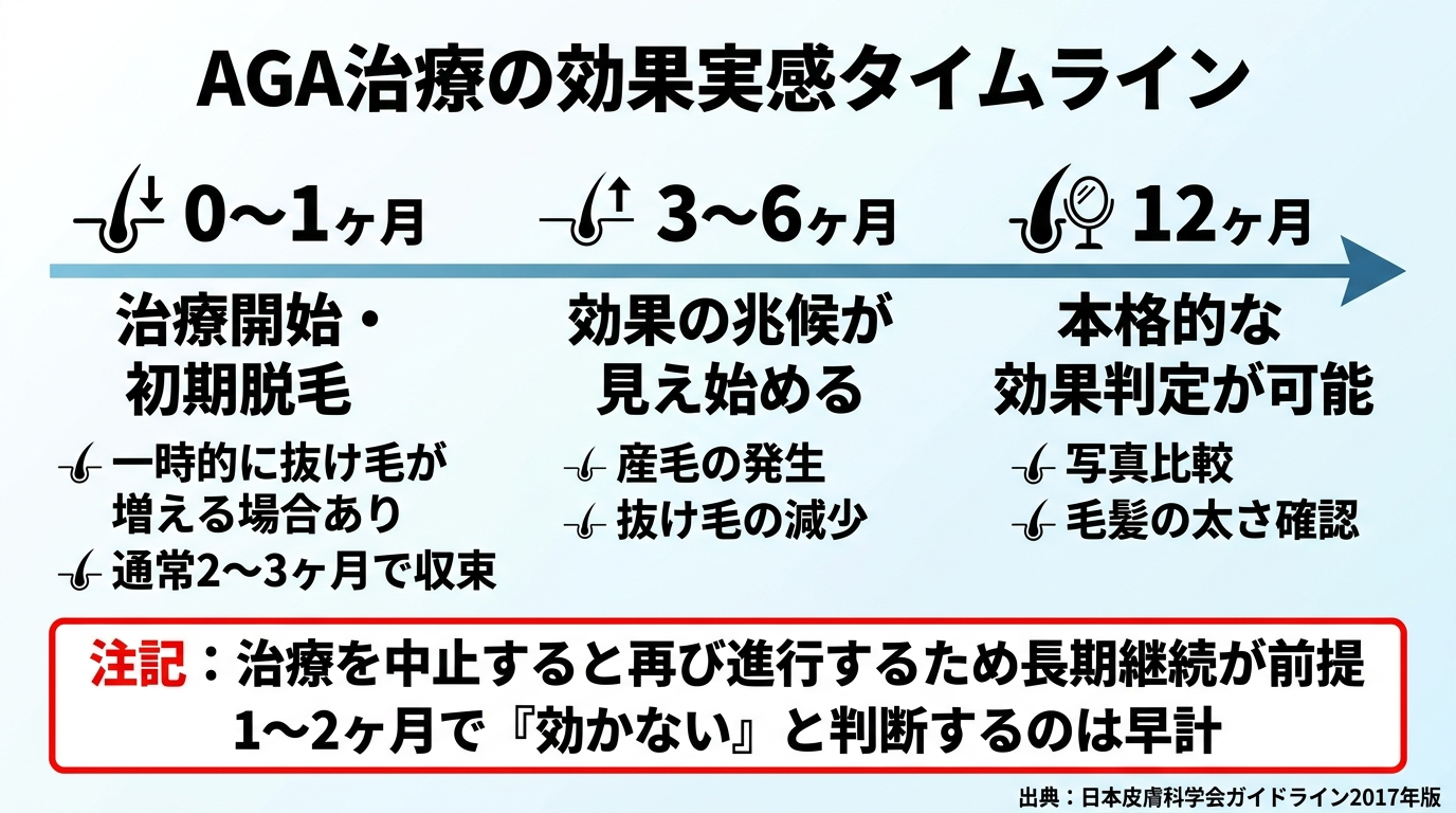 タイトル: AGA治療の効果実感タイムライン。横向き時間軸グラフ。0〜1ヶ月: 治療開始・初期脱毛(一時的に抜け毛が増える場合あり、通常2〜3ヶ月で収束)。3〜6ヶ月: 効果の兆候が見え始める。12ヶ月: 本格的な効果判定が可能。注記: 治療を中止すると再び進行するため長期継続が前提。1〜2ヶ月で『効かない』と判断するのは早計。出典: 日本皮膚科学会ガイドライン2017年版。