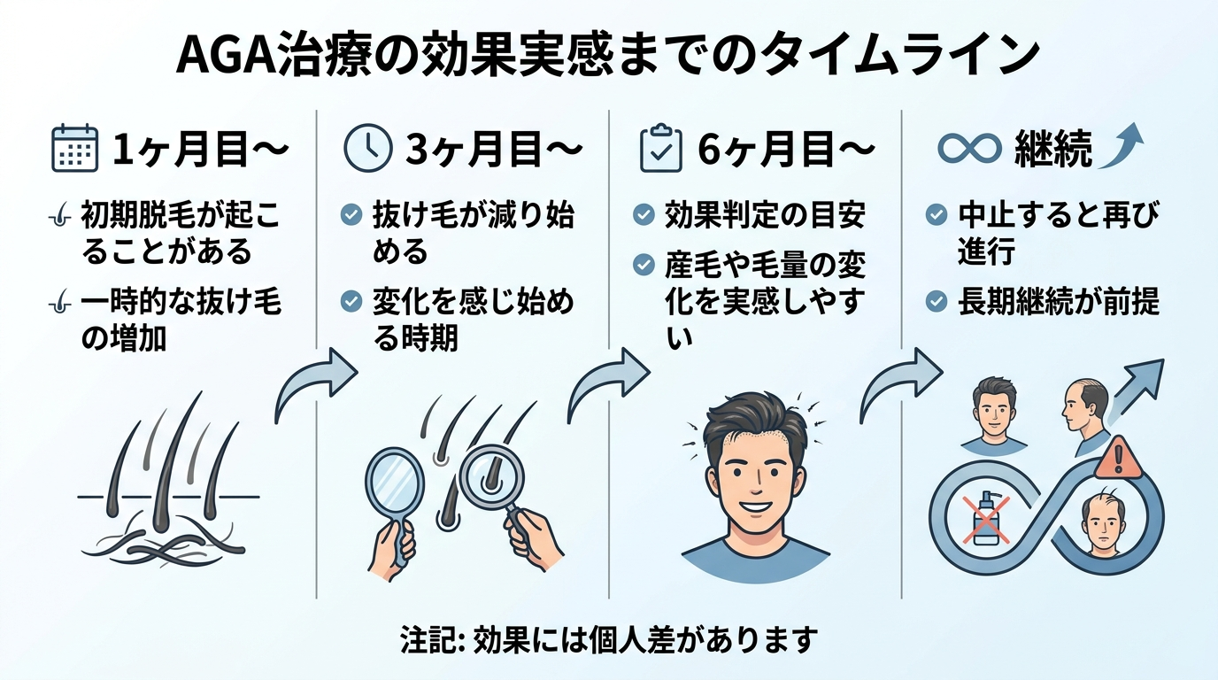 タイトル: AGA治療の効果実感までのタイムライン。横方向の時間軸で4段階: 1ヶ月目〜(初期脱毛が起こることがある。一時的な抜け毛の増加)→ 3ヶ月目〜(抜け毛が減り始める。変化を感じ始める時期)→ 6ヶ月目〜(効果判定の目安。産毛や毛量の変化を実感しやすい)→ 継続(中止すると再び進行するため長期継続が前提)。注記: 効果には個人差があります。