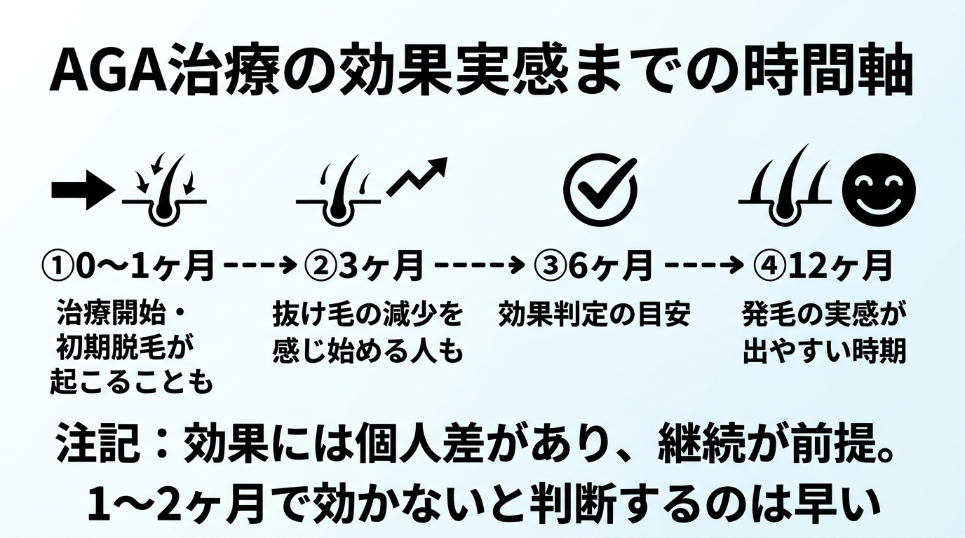 タイトル: AGA治療の効果実感までの時間軸。横向きのタイムライン図: 0〜1ヶ月『治療開始・初期脱毛が起こることも』→ 3ヶ月『抜け毛の減少を感じ始める人も』→ 6ヶ月『効果判定の目安』→ 12ヶ月『発毛の実感が出やすい時期』。注記: 効果には個人差があり、継続が前提。1〜2ヶ月で効かないと判断するのは早い