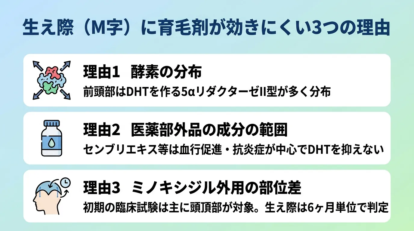 生え際（M字）に育毛剤が効きにくい3つの理由