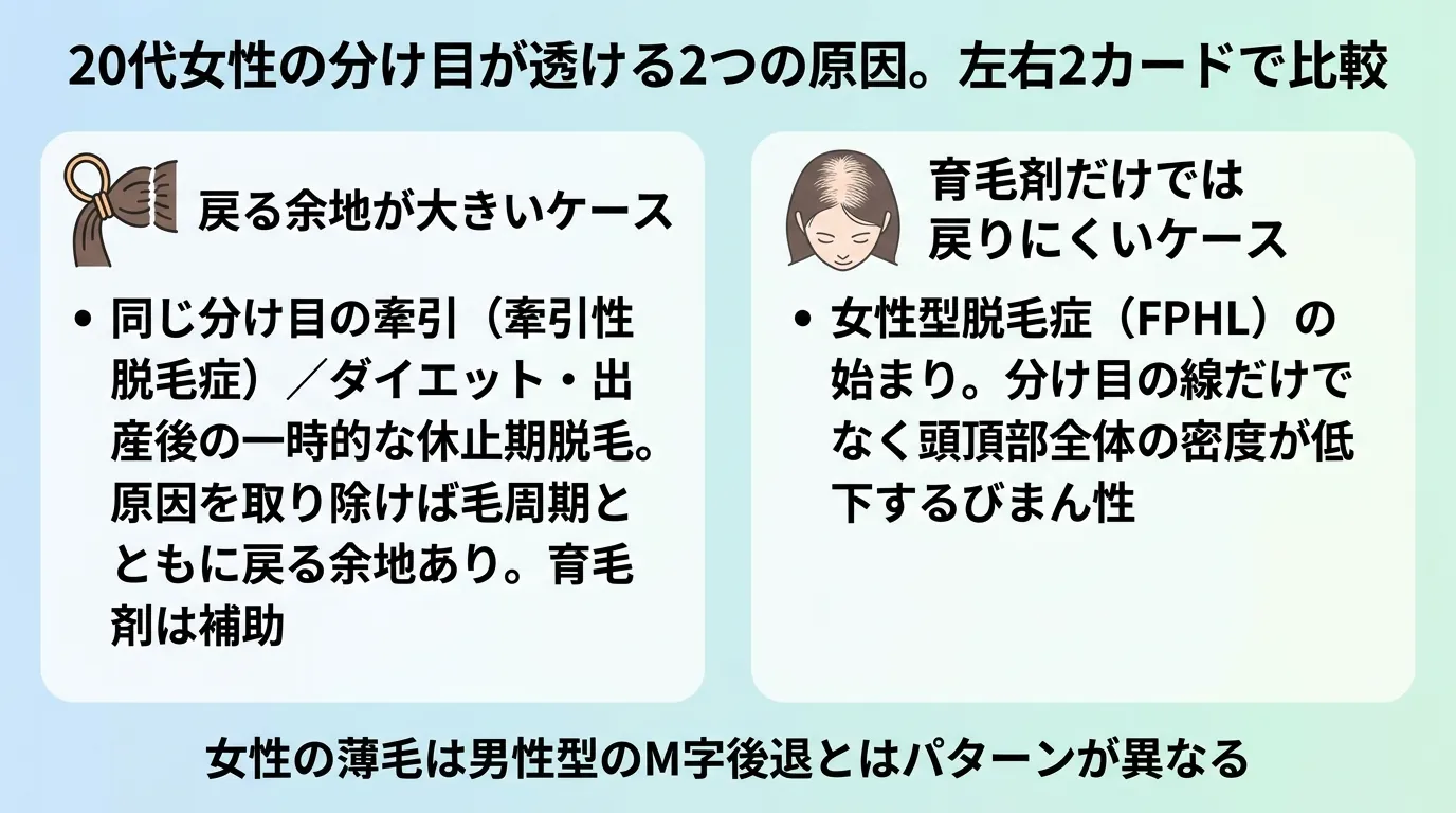 20代女性の分け目が透ける2つの原因