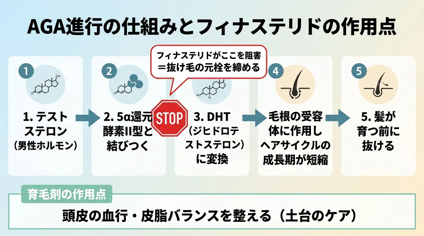AGAが進む仕組みとフィナステリドの作用点
