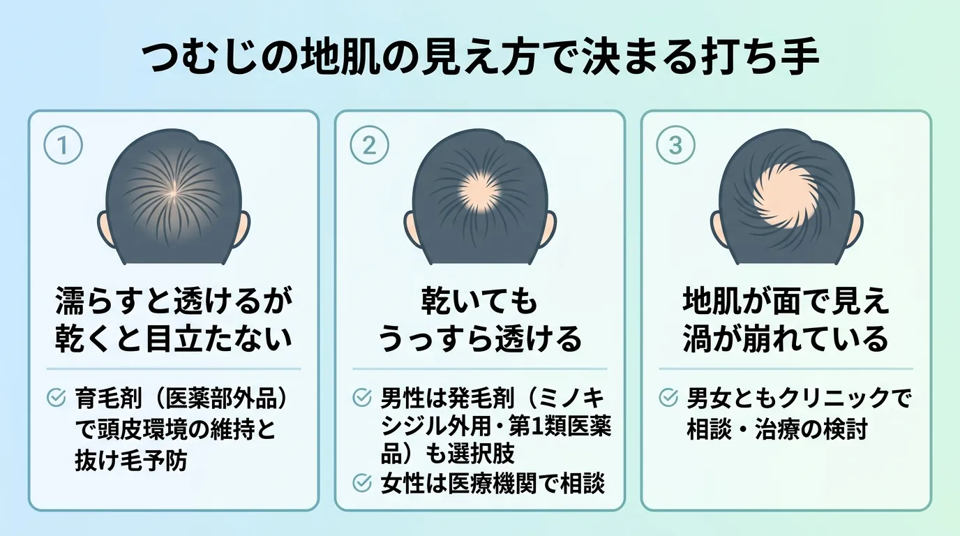 つむじの地肌の見え方で決まる打ち手