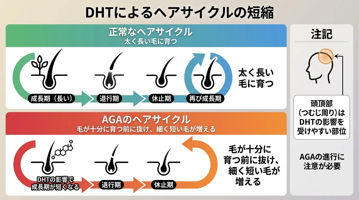 DHTによるヘアサイクルの短縮
