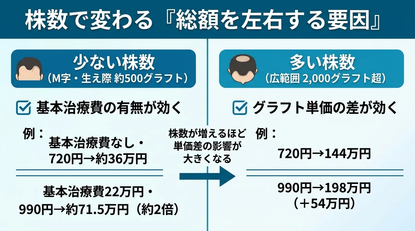 株数で変わる『総額を左右する要因』