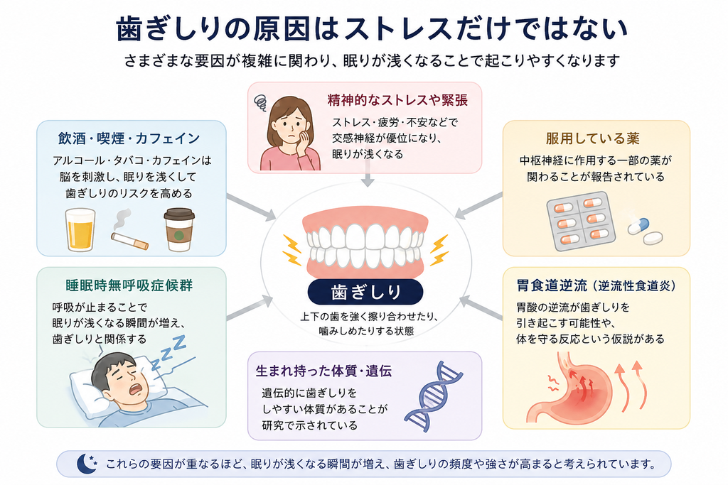 歯ぎしりの原因はストレスだけではなく、睡眠状態や嗜好品、薬、睡眠時無呼吸、胃食道逆流、遺伝など複数の要因が関係することを示した図解です。