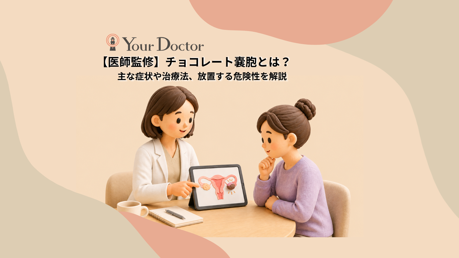 医師がタブレットのデフォルメ図を使い、チョコレート嚢胞ができる流れを患者へやさしく説明しているクレイ風3Dイラスト