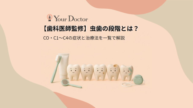 きれいな白い歯から、白い濁り、小さな茶色の点、大きな茶色のしみ、上が欠けた歯へと、虫歯の段階（COからC4）を順に表した5本の歯が並び、歯ブラシや歯磨き粉が添えられている。